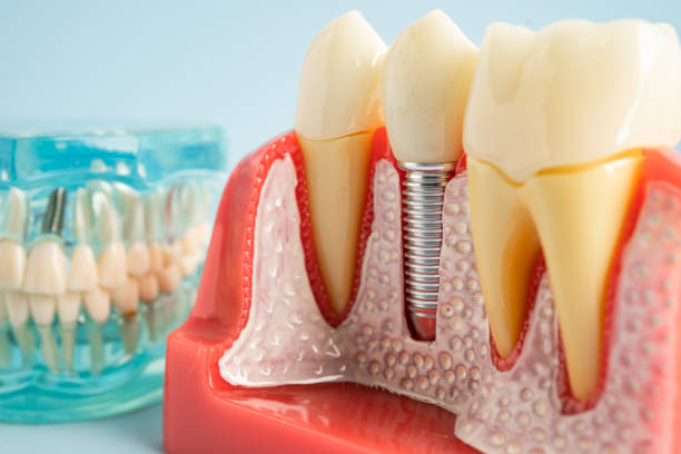 Best Dental Exams and Cleanings  in Baiting Hollow, NY